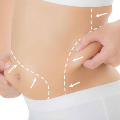 SculpSure-fat-burning-and-body-contouring